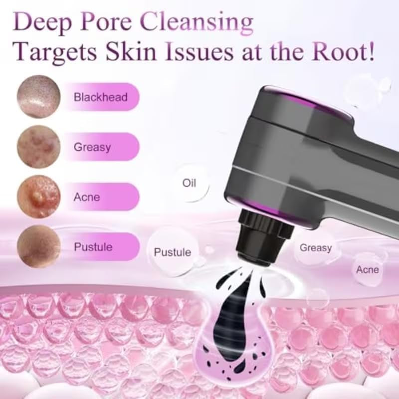 Blackhead Removers Pore Vacuum with Heating，5 Suction Heads & 3 Adjustable Suction Levels ，For Nose & Face Deep Pore Cleansing