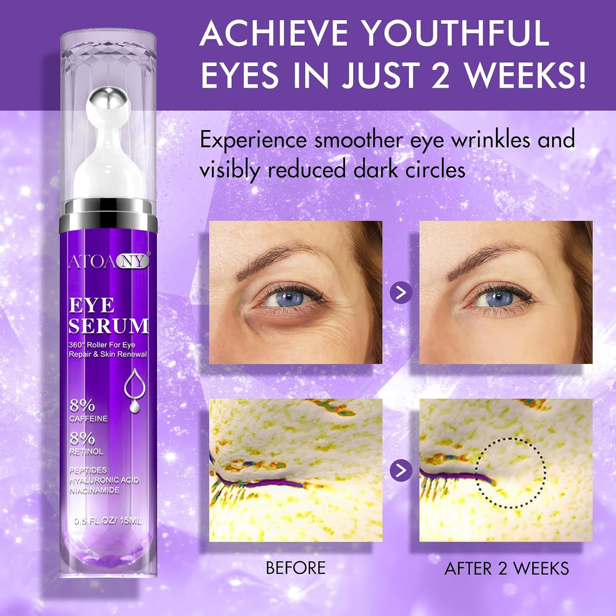 Eye Treatment Serum - 8% Caffeine & Retinol, Hyaluronic Acid, Niacinamide, Peptides - Cream for Dark Circles, Puffy Eyes, Fine Lines - 360° Eye Roller Massage Ball Included, 0.5 Fl. Oz