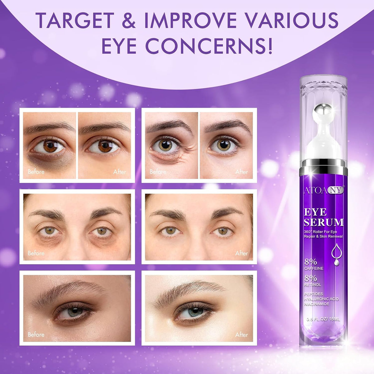 Eye Treatment Serum - 8% Caffeine & Retinol, Hyaluronic Acid, Niacinamide, Peptides - Cream for Dark Circles, Puffy Eyes, Fine Lines - 360° Eye Roller Massage Ball Included, 0.5 Fl. Oz